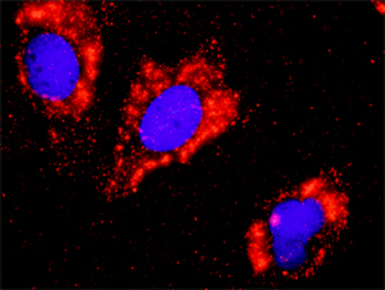 FLT1 purified MaxPab rabbit polyclonal antibody (D01P)