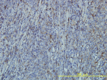 FLNA monoclonal antibody (M01), clone 4E10-1B2