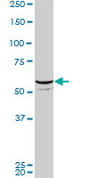 FLI1 monoclonal antibody (M06), clone 2D6