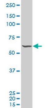 FLI1 monoclonal antibody (M06), clone 2D6