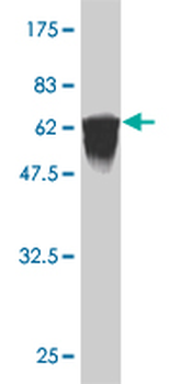 FLI1 monoclonal antibody (M06), clone 2D6