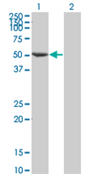 FLI1 monoclonal antibody (M05), clone 1F6