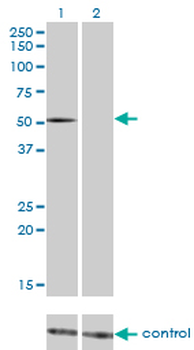 FLI1 monoclonal antibody (M05), clone 1F6