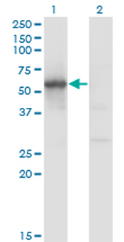 FLI1 monoclonal antibody (M01), clone 1G8