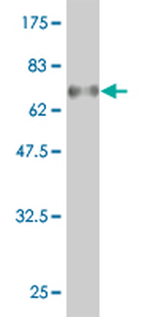 FLI1 monoclonal antibody (M01), clone 1G8