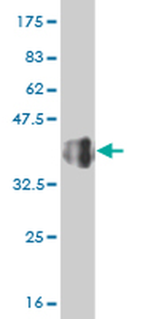 FOXO3A monoclonal antibody (M03), clone 1F6