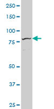FOXM1 monoclonal antibody (M09), clone 1D3