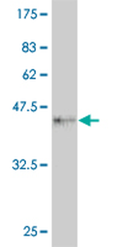 FOXM1 monoclonal antibody (M09), clone 1D3