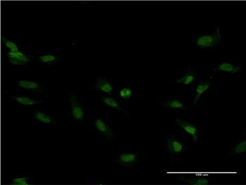FOXM1 monoclonal antibody (M07), clone 2E2