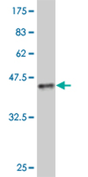 FOXM1 monoclonal antibody (M07), clone 2E2