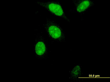 FOXM1 monoclonal antibody (M05), clone 2H4