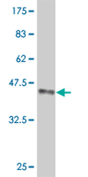 FOXM1 monoclonal antibody (M05), clone 2H4