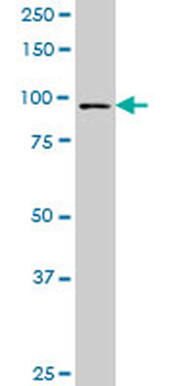 FOXM1 monoclonal antibody (M02), clone 5G10