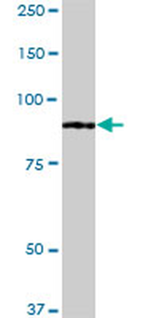 FOXM1 monoclonal antibody (M02), clone 5G10