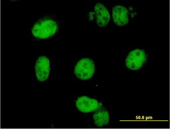 FOXM1 monoclonal antibody (M02), clone 5G10