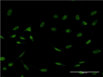 FOXC2 monoclonal antibody (M16), clone 1D4