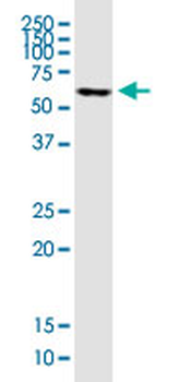 FOXC2 monoclonal antibody (M04), clone 1A8