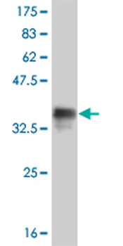 FOXC2 monoclonal antibody (M04), clone 1A8