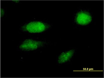 FOXC2 monoclonal antibody (M02), clone 2H3