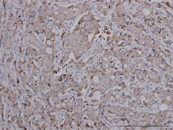 FOXC2 monoclonal antibody (M02), clone 2H3
