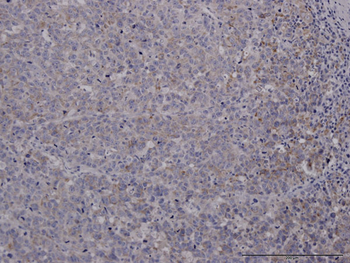 FOXC2 monoclonal antibody (M02), clone 2H3