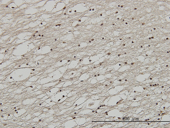 FOXC2 monoclonal antibody (M02), clone 2H3