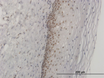 FOXL1 monoclonal antibody (M09), clone 2F6