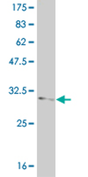 FOXL1 monoclonal antibody (M09), clone 2F6