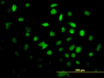 FOXF2 monoclonal antibody (M08), clone 3D11