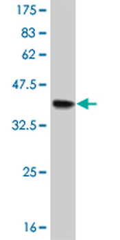 FOXF2 monoclonal antibody (M08), clone 3D11