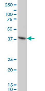 FOXF2 monoclonal antibody (M04), clone 2G10