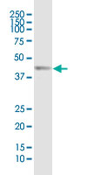 FOXF2 monoclonal antibody (M04), clone 2G10