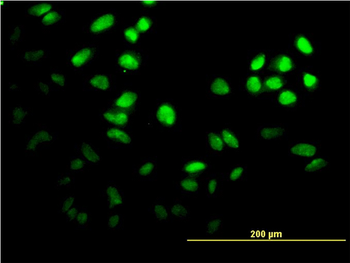 FOXF2 monoclonal antibody (M04), clone 2G10