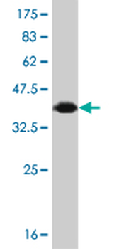 FOXF2 monoclonal antibody (M04), clone 2G10