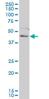 FOXF2 monoclonal antibody (M01), clone 2D7