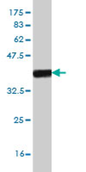 FOXF2 monoclonal antibody (M01), clone 2D7