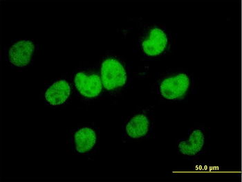 FKBP5 monoclonal antibody (M02), clone 3D1-1B10