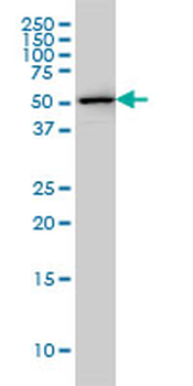 FKBP5 monoclonal antibody (M01), clone 3D10-1G11