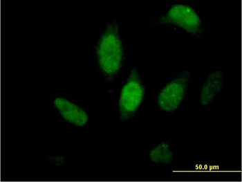 FKBP5 purified MaxPab mouse polyclonal antibody (B01P)