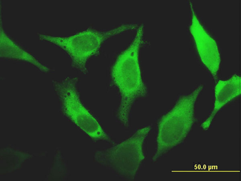 FHIT monoclonal antibody (M07), clone 1H2