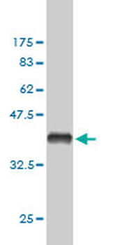 FHIT monoclonal antibody (M07), clone 1H2
