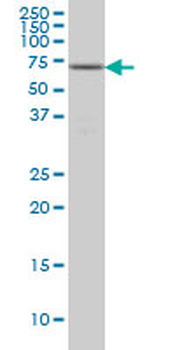 FGR monoclonal antibody (M03), clone 1B12