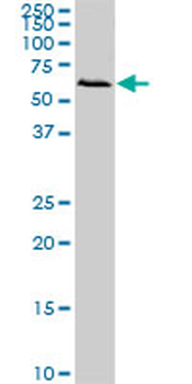 FGR monoclonal antibody (M03), clone 1B12