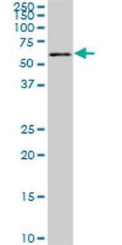 FGR monoclonal antibody (M03), clone 1B12