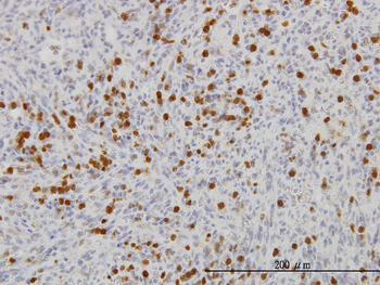 FGR monoclonal antibody (M03), clone 1B12