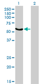 FGR monoclonal antibody (M03), clone 1B12