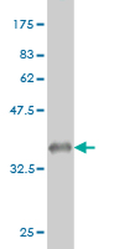 FGR monoclonal antibody (M03), clone 1B12