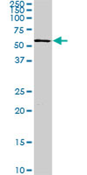 FGR monoclonal antibody (M02), clone 3B11