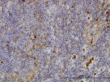FGR monoclonal antibody (M02), clone 3B11