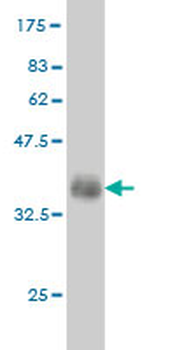 FGR monoclonal antibody (M02), clone 3B11